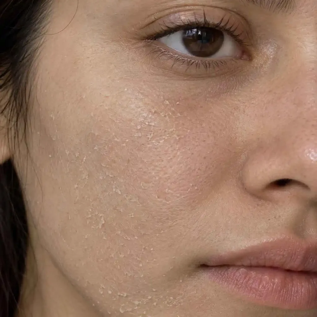 How-Hard-Water-Can-Affect-Your-Skin
